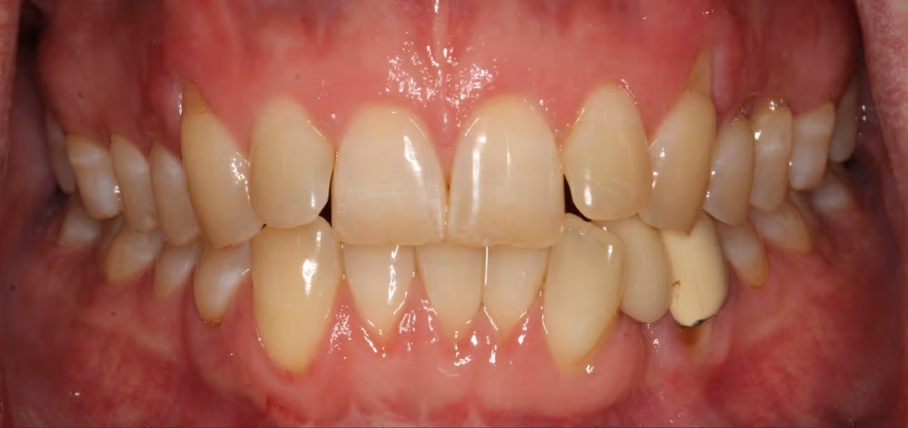 Before Image