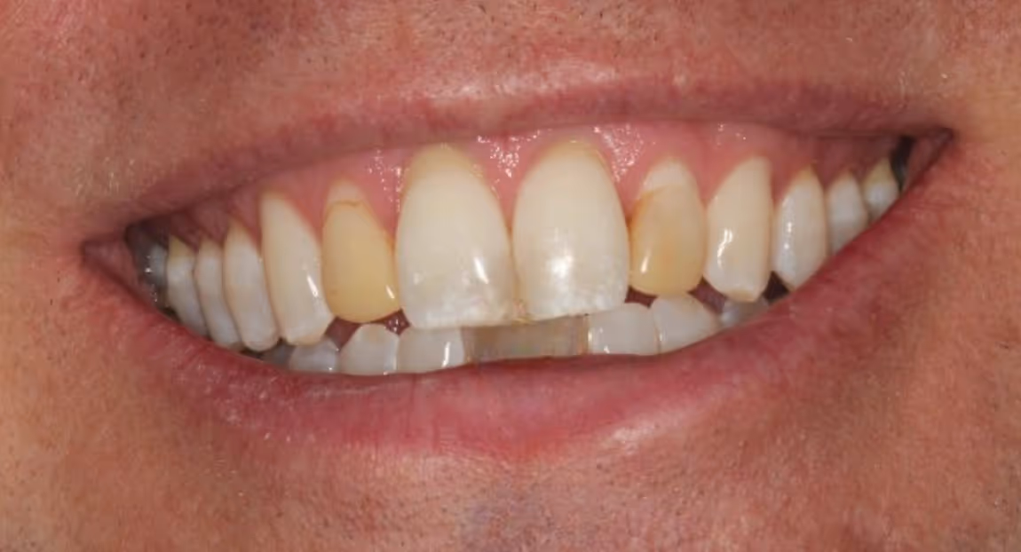 Before Image