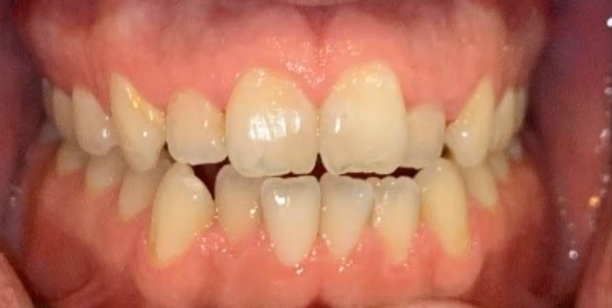 Before Image