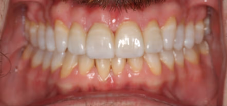 After Image