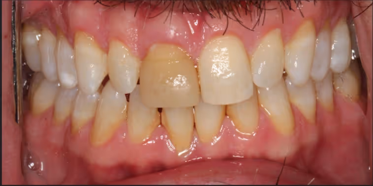 Before Image
