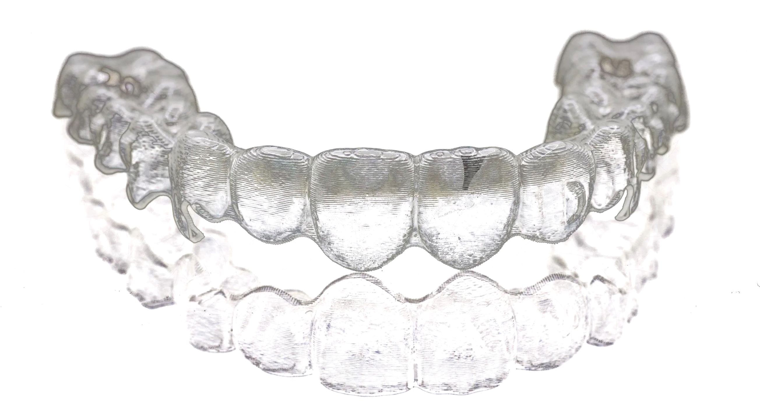 Clear aligner