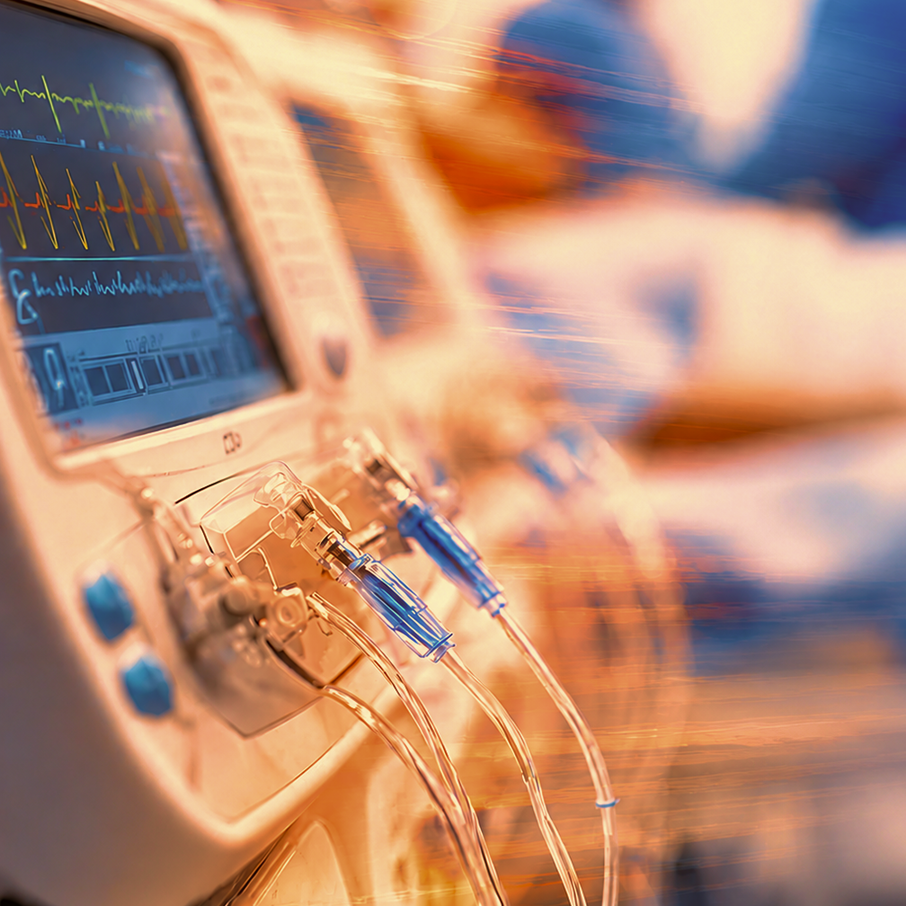 Close-up of a medical device with a screen displaying heart rate and other vital signs, connected to transparent tubes with blue connectors.