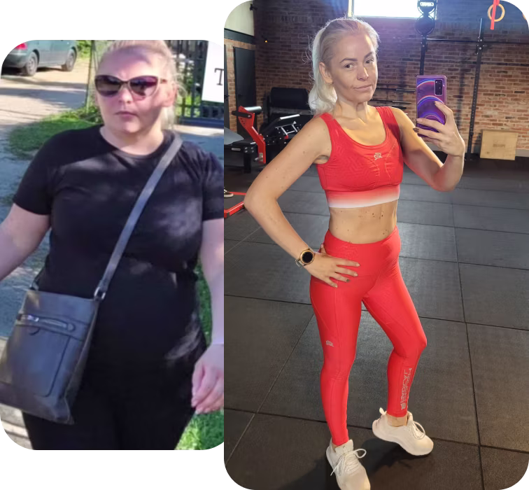 Ewa – metamorfoza z BeDiet (zdjęcie przed i po)