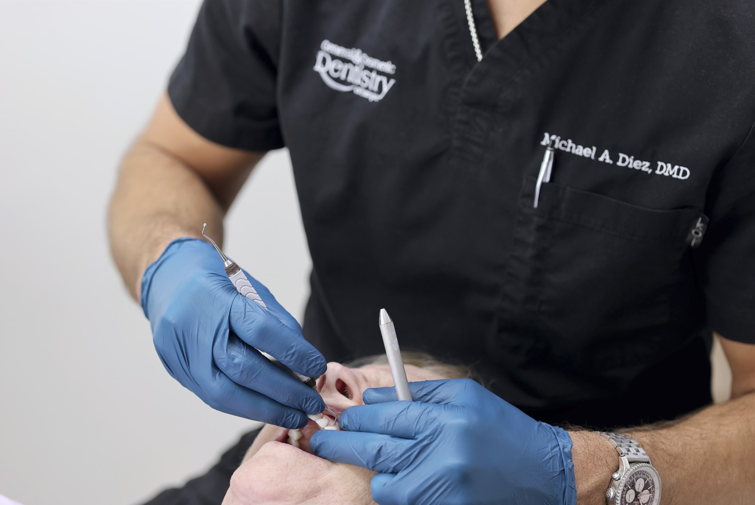 dental implants