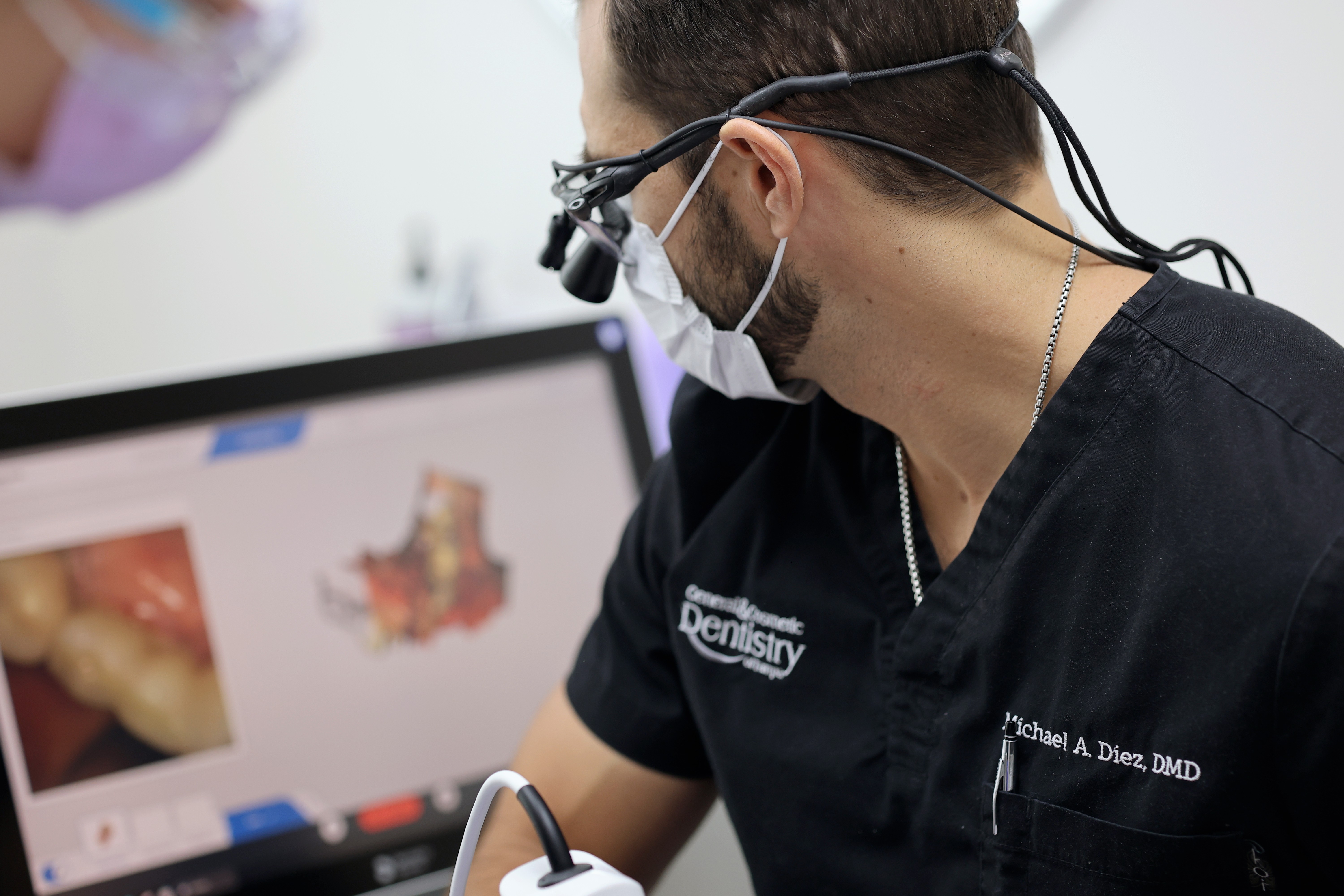 oral cancer screening