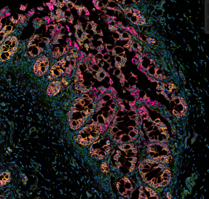 Spatial Transcriptomics