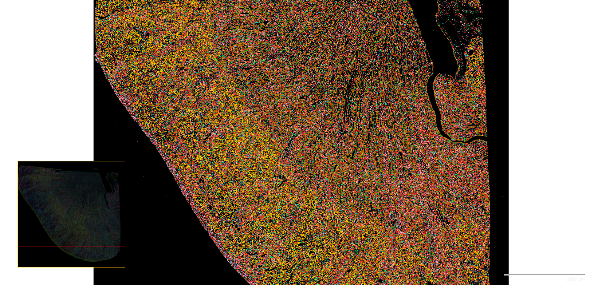 Spatial Biology Visualization