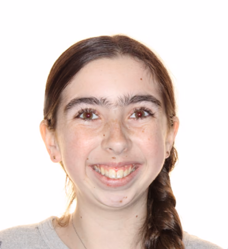 Patient before treatment at Lindner Dental Associates