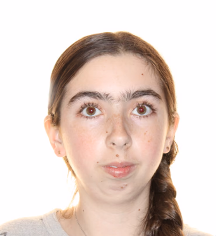 Patient before treatment at Lindner Dental Associates