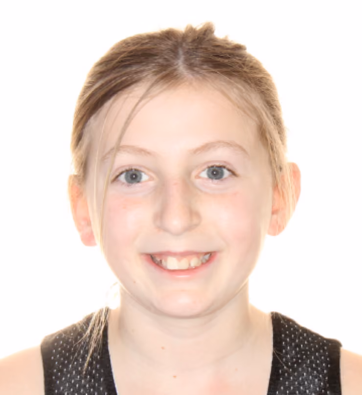 Patient before treatment at Lindner Dental Associates