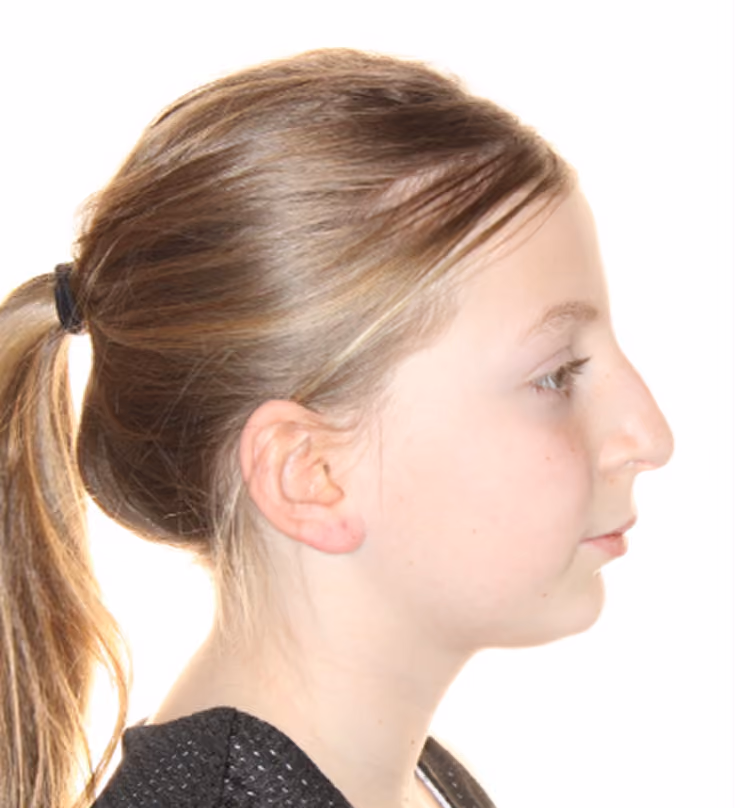 Patient before treatment at Lindner Dental Associates