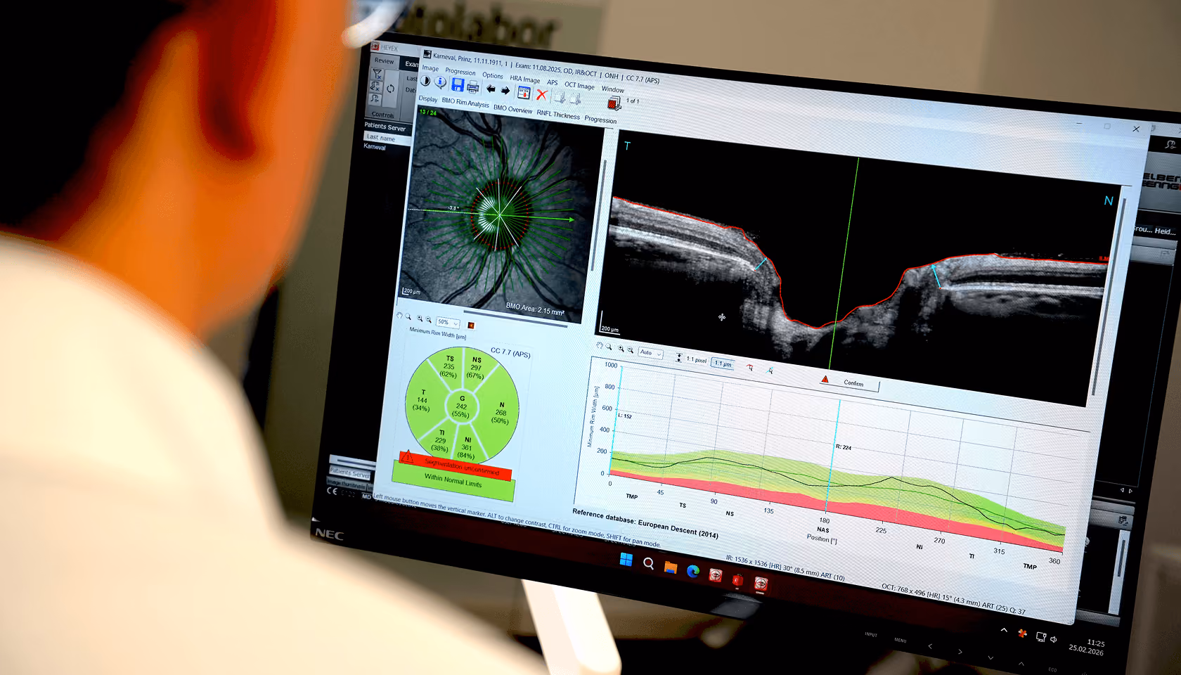 Person betrachtet Augen-Scan auf Computerbildschirm, zeigt Diagramme und grafische Darstellungen medizinischer Daten.