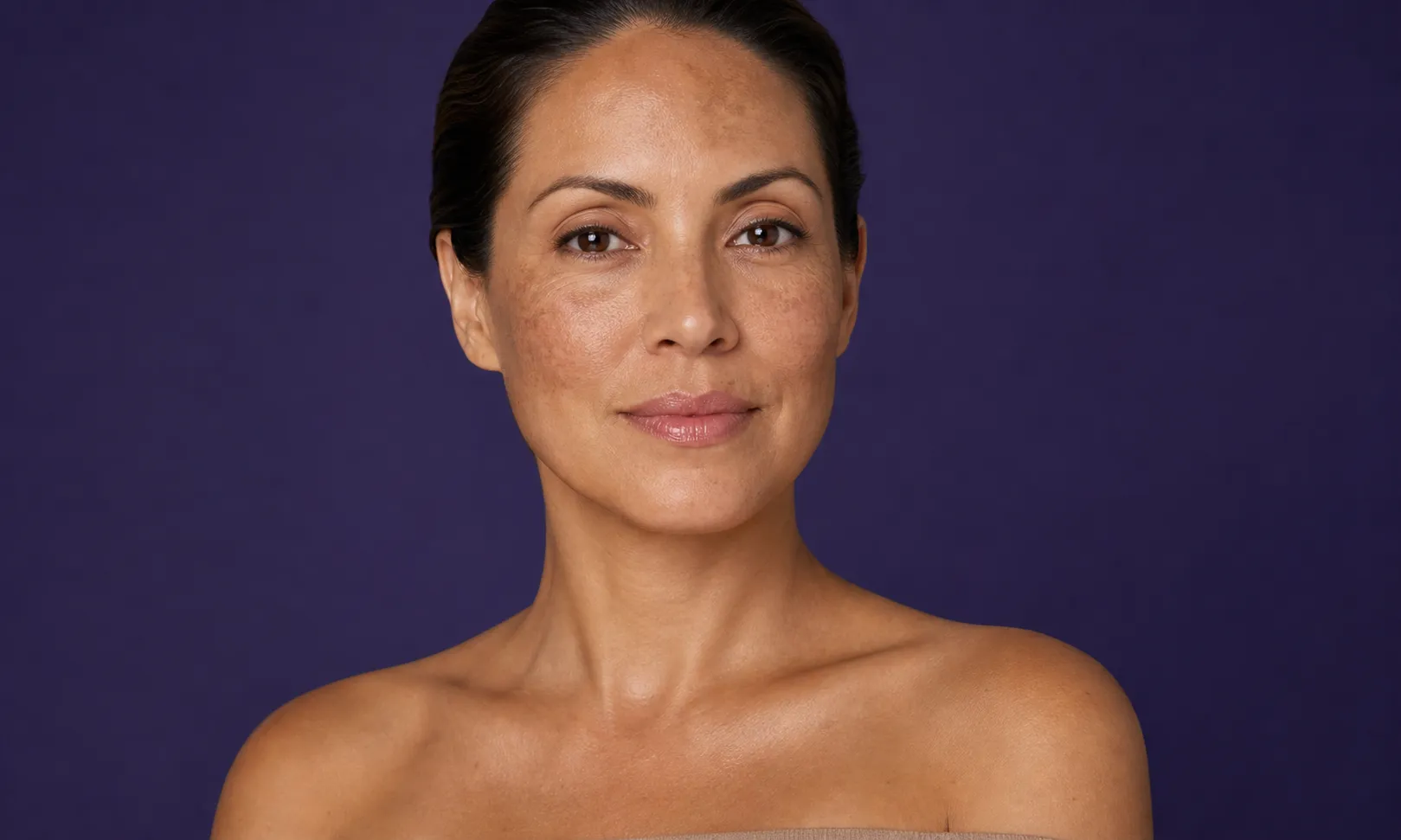Femme regardant la caméra avec le visage éclatant et des taches pigmentaires sur la peau.