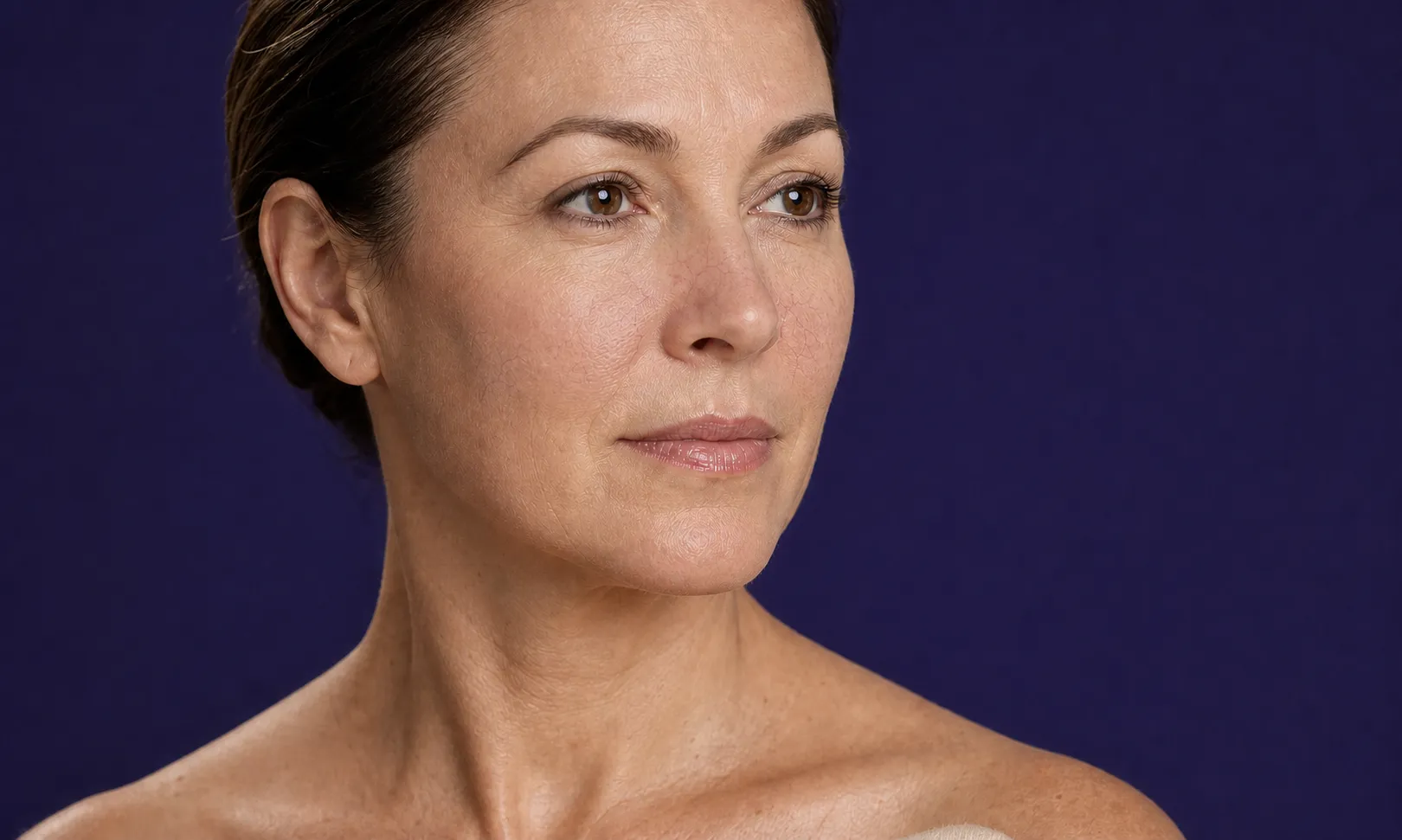 Portrait d'une femme regardant à droite avec des veines visibles sur la joue gauche.