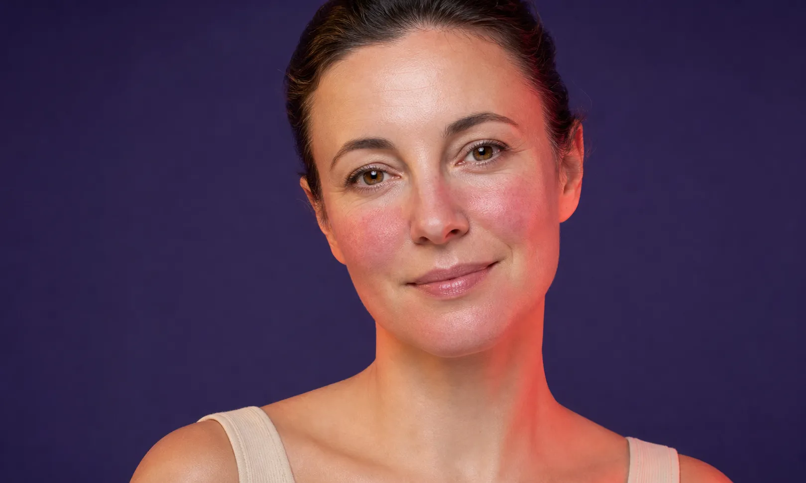 Femme avec rougeurs visibles sur les joues et un sourire doux sur un fond violet.