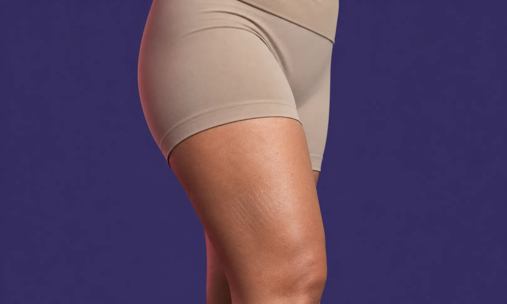 Cuisse montrant des vergetures visibles sur une peau bronzée avec un fond violet.