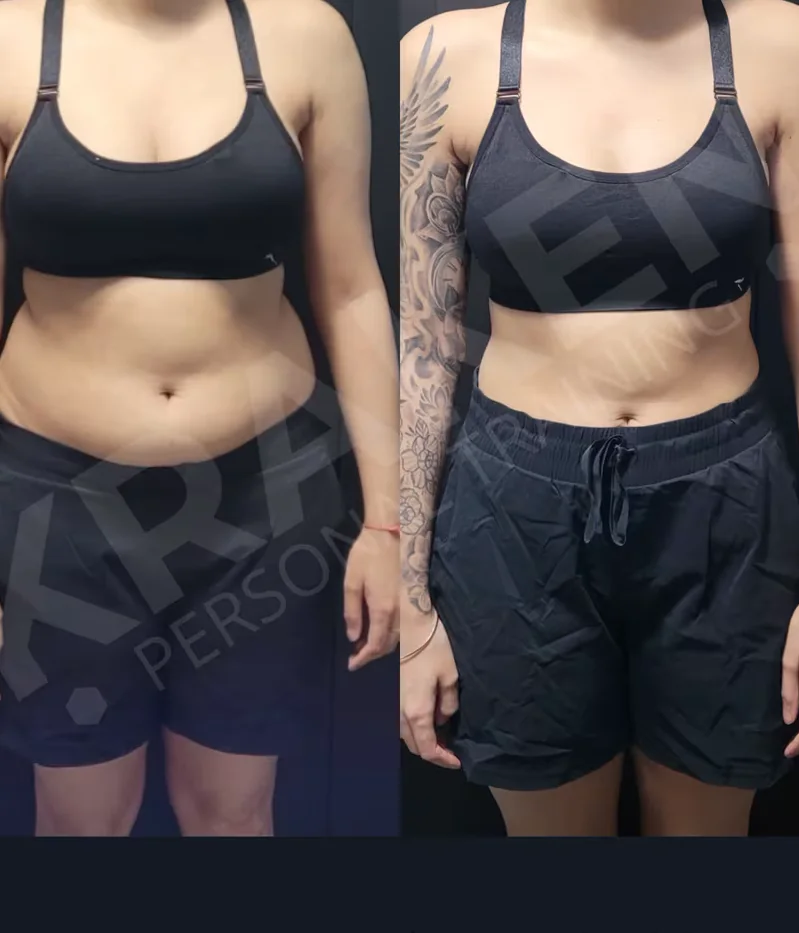 Harkirat K. before and after photos at Kraken
