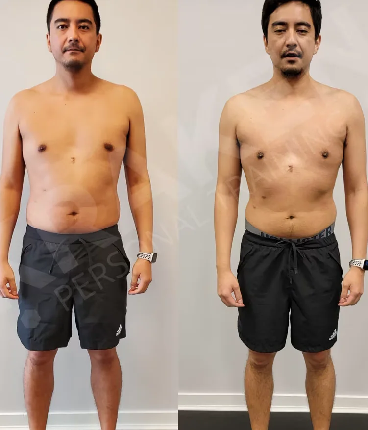 Gui H. before and after photos at Kraken