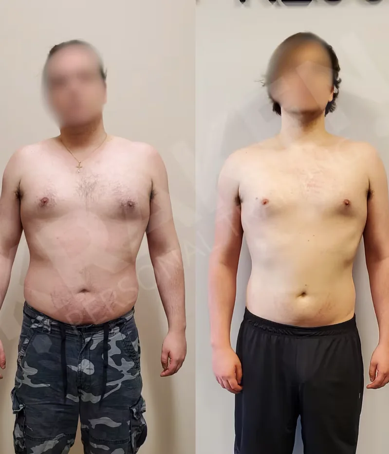 Michael N. before and after photos at Kraken