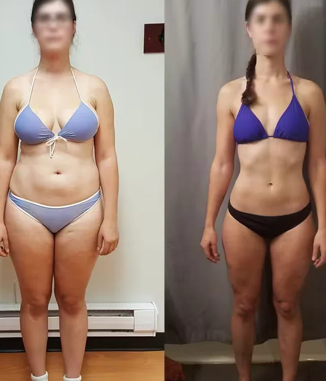 Kim S. before and after photos at Kraken