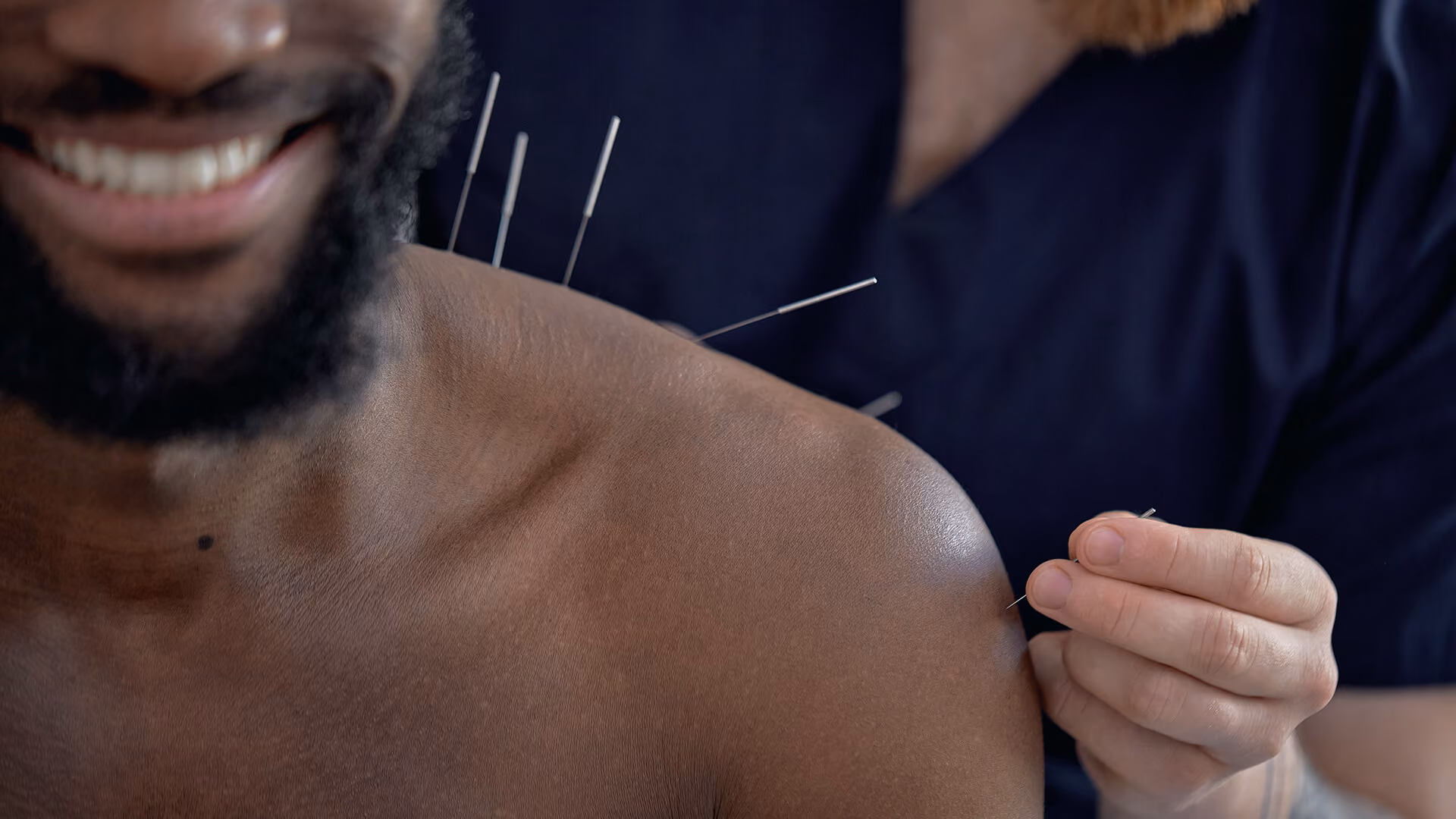 Médecin réalisant une séance d’acupuncture sur le dos d’un patient allongé.