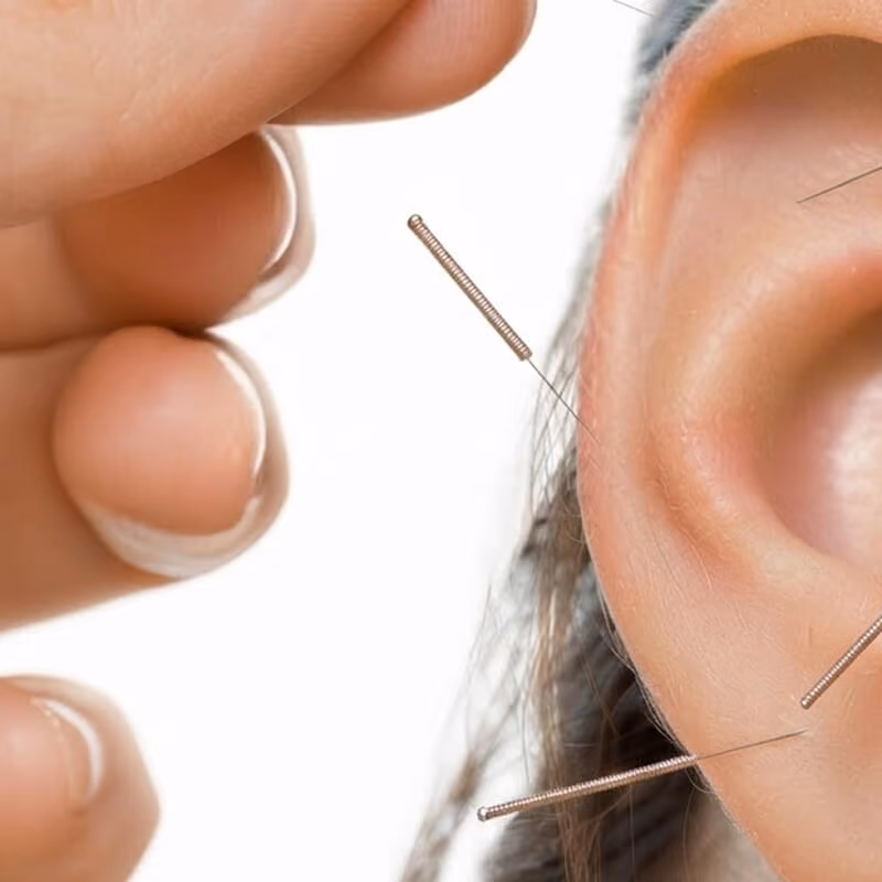 Médecin stimulant un point de l’oreille lors d’une séance d’auriculothérapie.