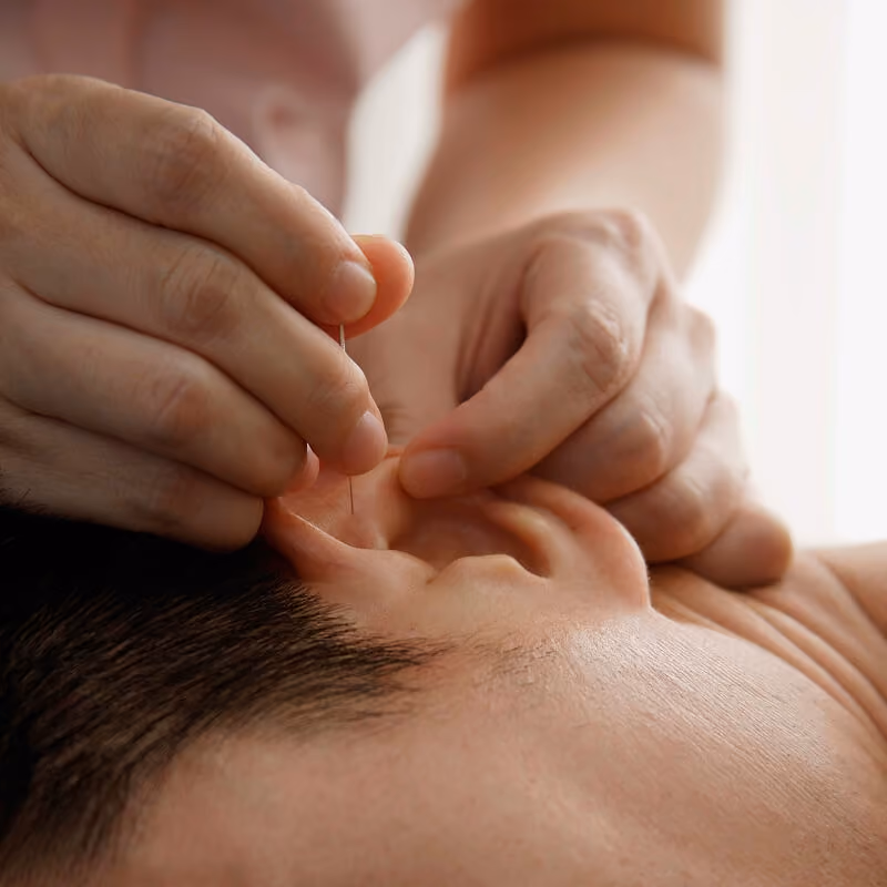 Gros plan sur l’oreille d’un patient pendant un traitement d’auriculothérapie.