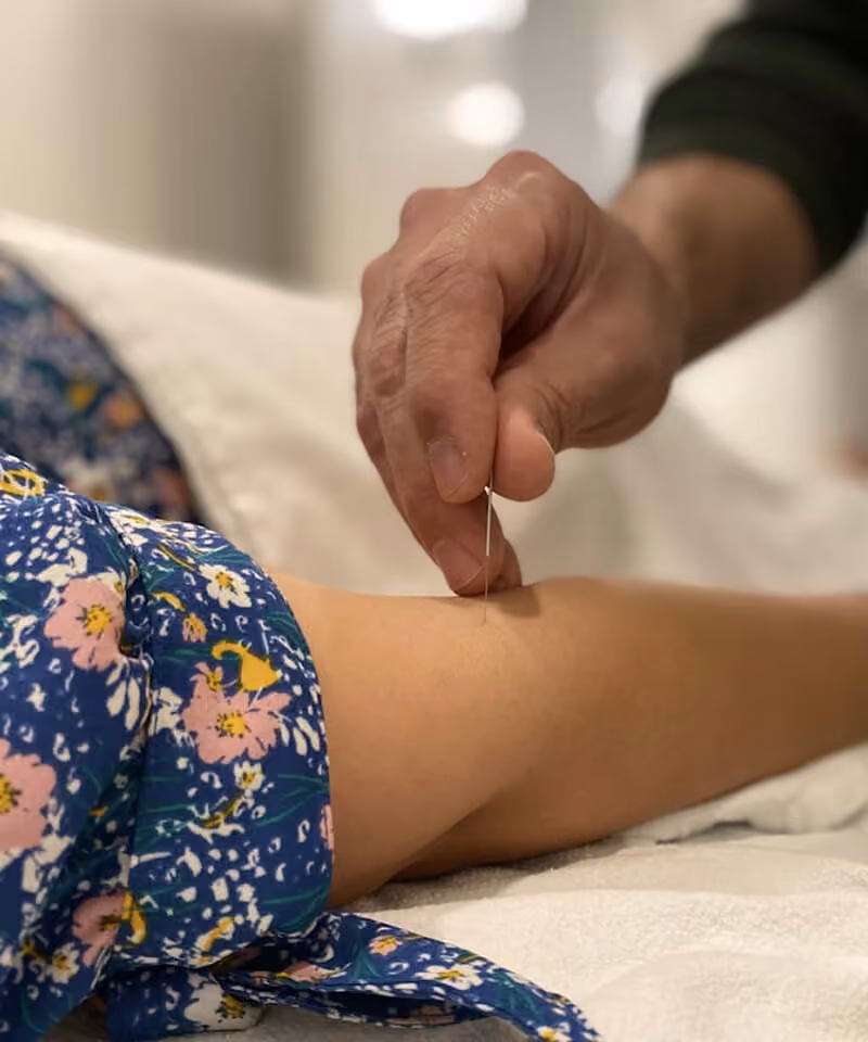Médecin préparant une aiguille d’acupuncture près du corps d’un patient allongé.
