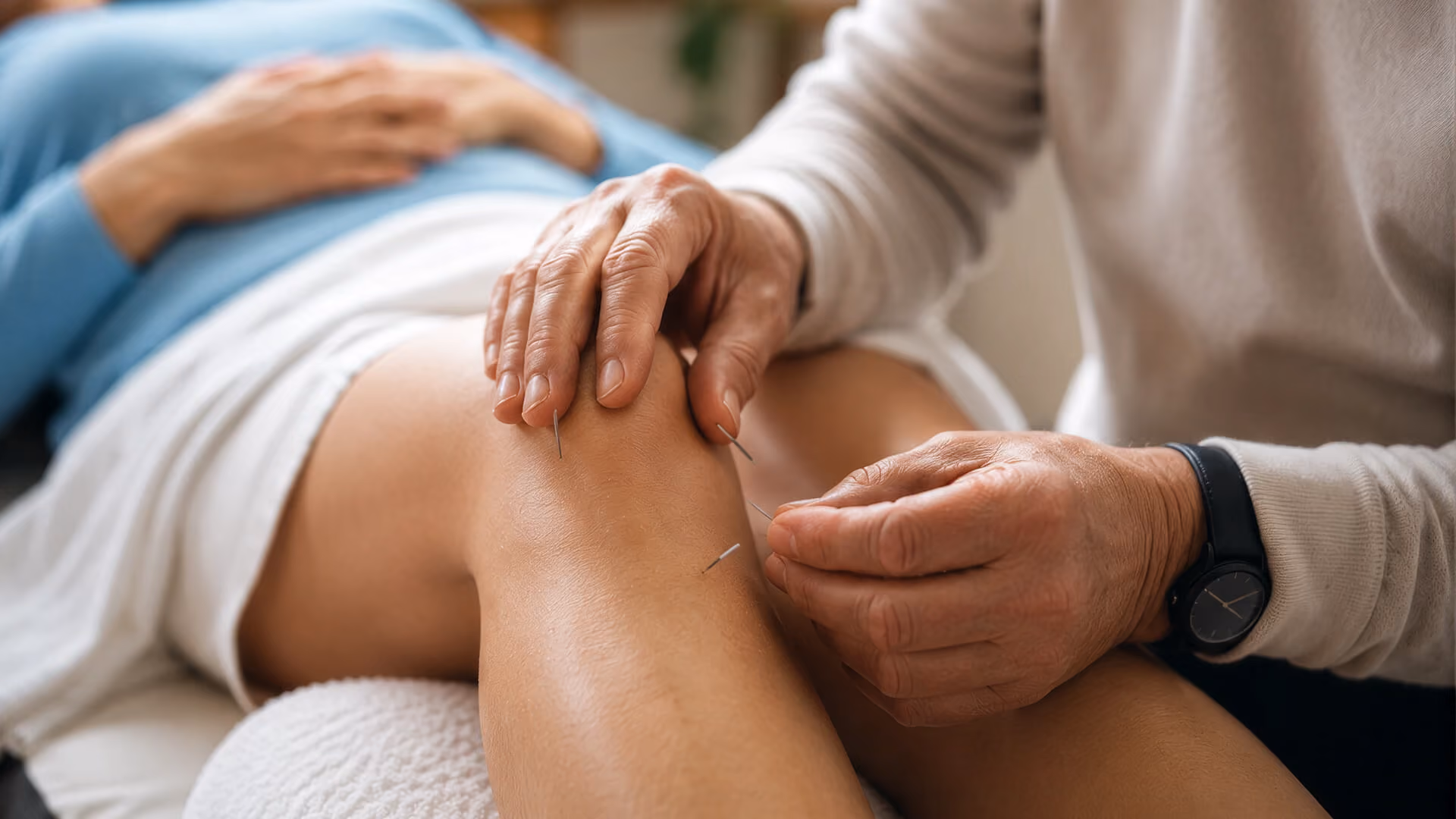 Médecin manipulant une aiguille d’acupuncture près du bras d’un patient.