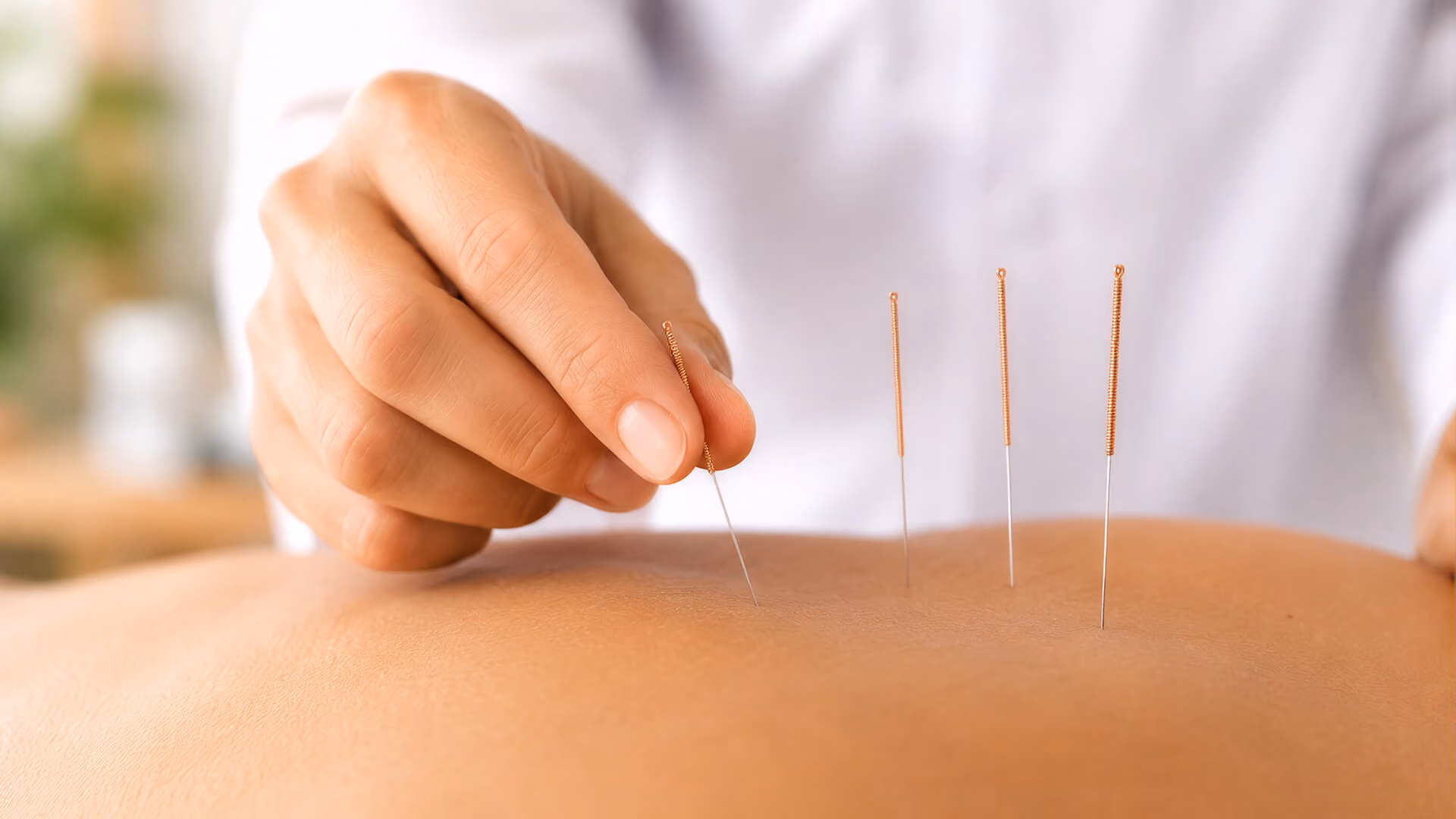 Médecin tenant une aiguille d’acupuncture près du visage d’un patient allongé.