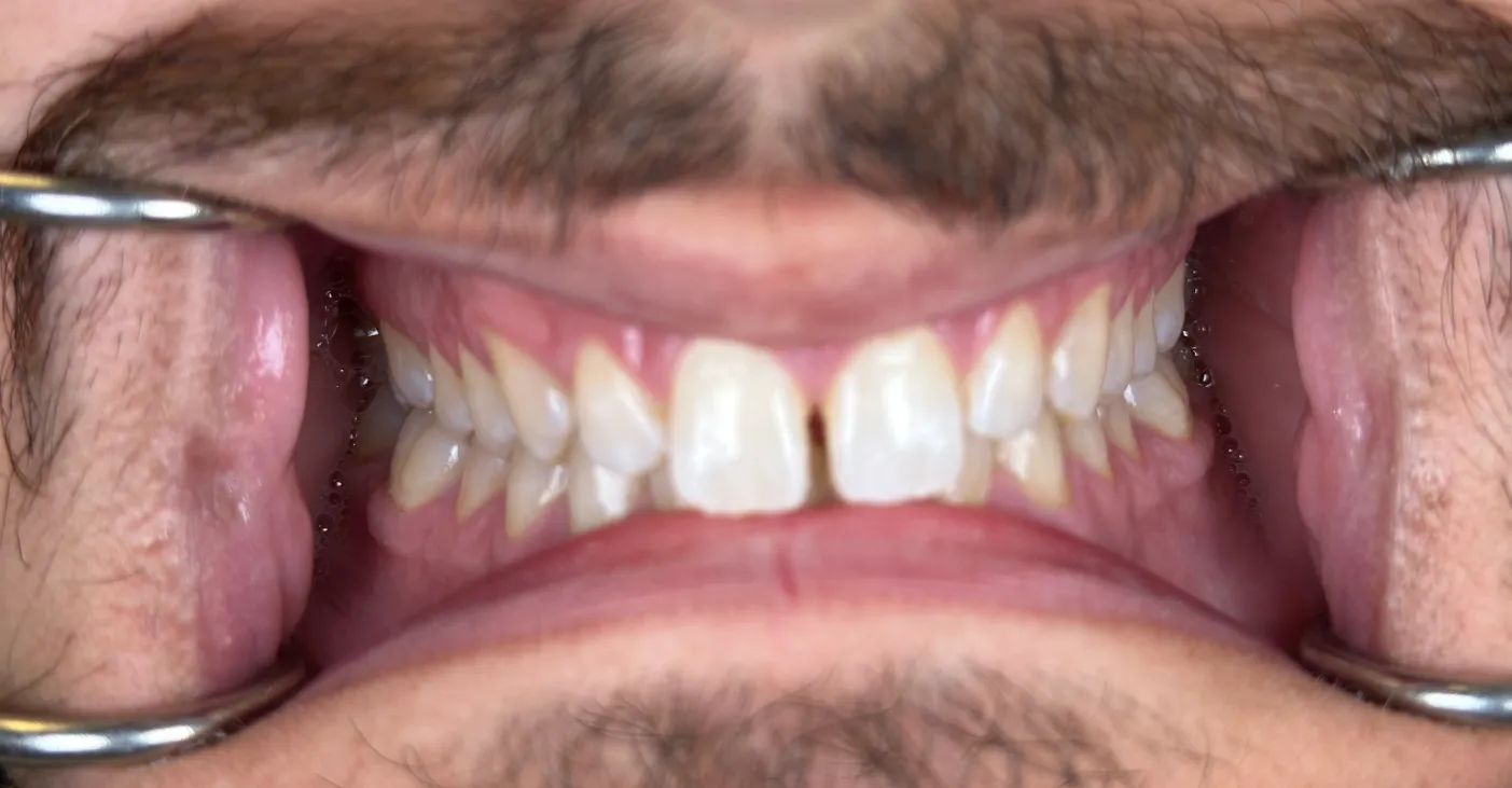 Before Image