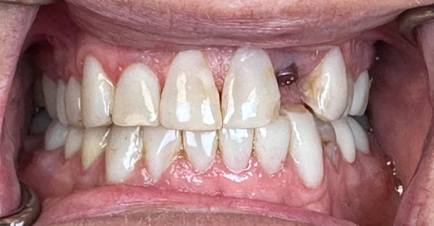 Before Image