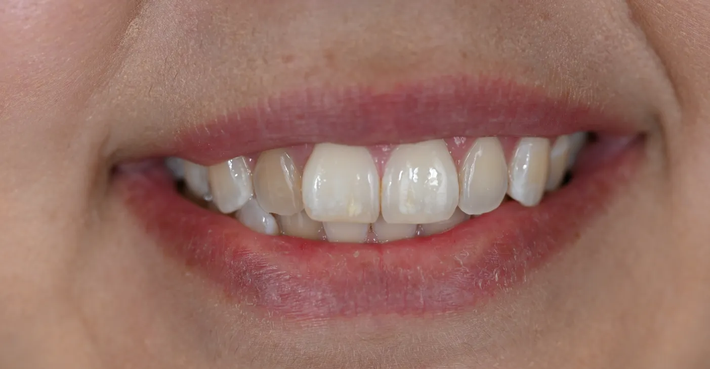 Before Image