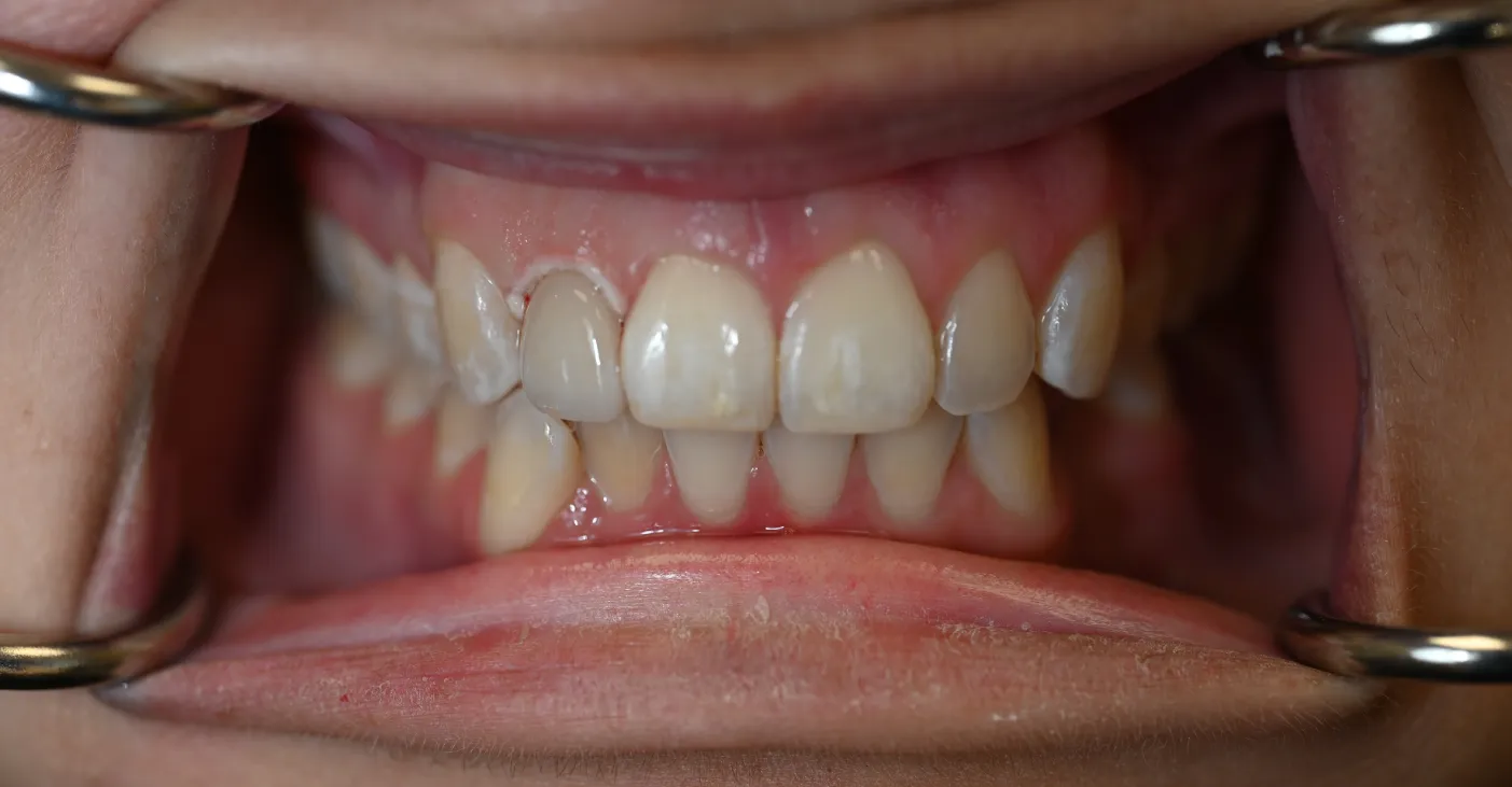 After Image