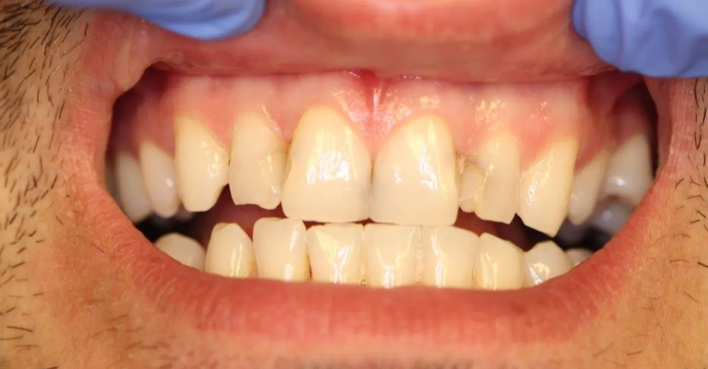 Before Image