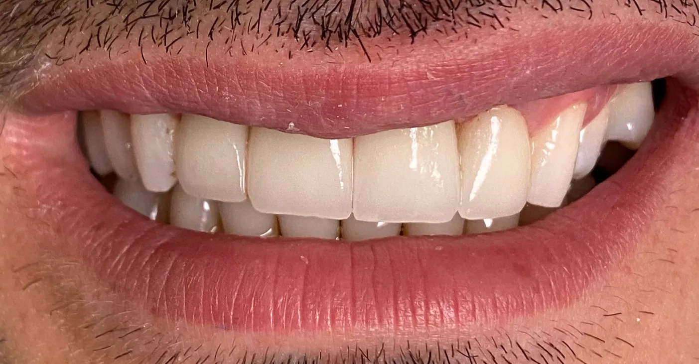 After Image