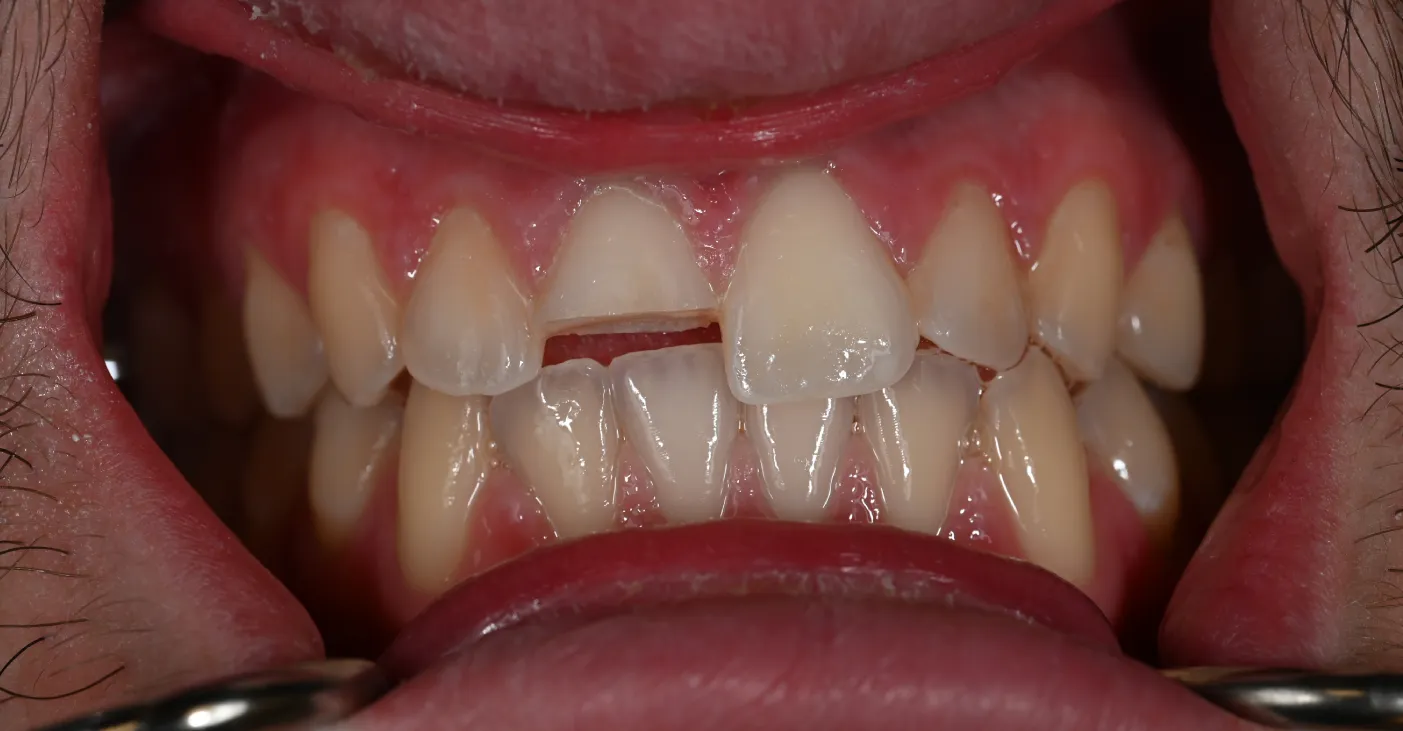 Before Image