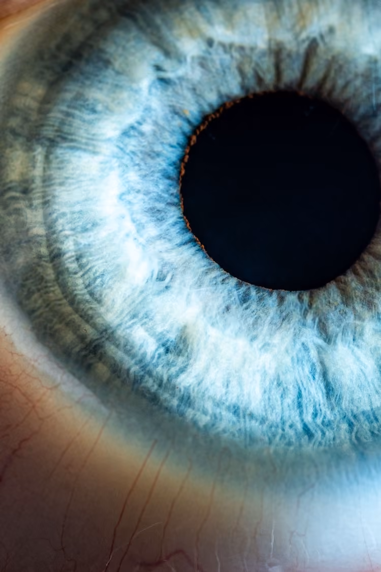 The eye is shown with a dark pupil and light iris surrounded by blue-tinted sclera.