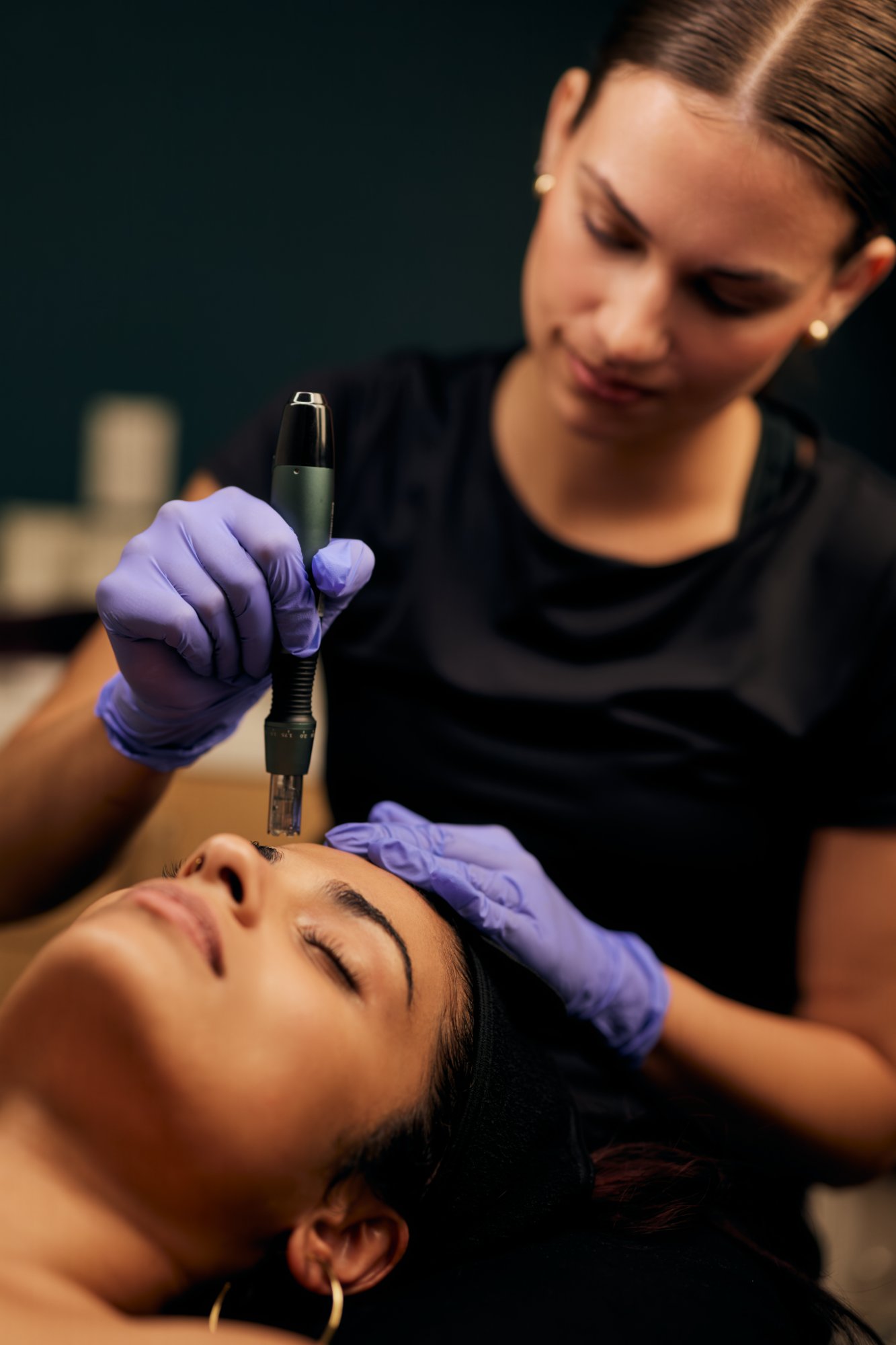 Microneedling treatment at Mod Facial in Plano, Texas