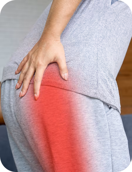 sciatica pain indicator