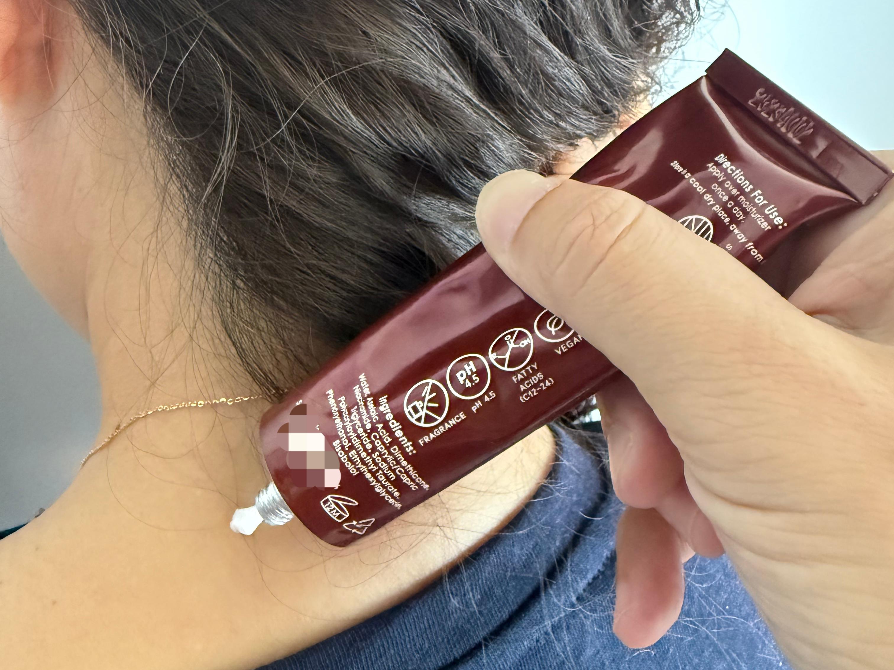 Close-up of the Malassezia-safe Azelaic Acid Cream tube being applied, showing the fragrance-free, pH 4.5, and C12-24-fatty-acid-free icons on the label