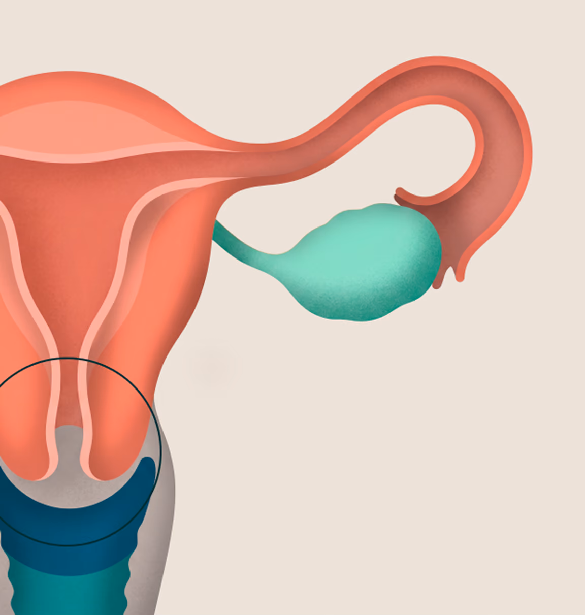 Illustration of the uterus, a fallopian tube and ovary, with a black circle highlighting the cervix at the base.