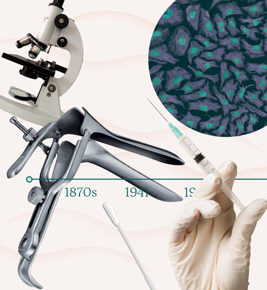 Timeline collage of a microscope, metal speculum, swab, and gloved syringe marked 1870s, 1941, 1951.
