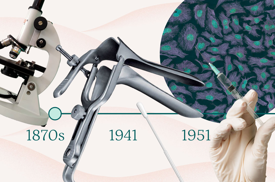 Timeline collage of a microscope, metal speculum, swab, and gloved syringe marked 1870s, 1941, 1951.