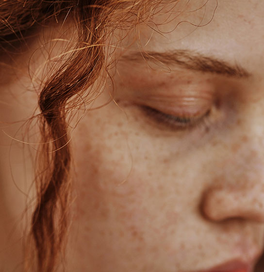 Close-up of a freckled face with red hair and eyes cast downward.
