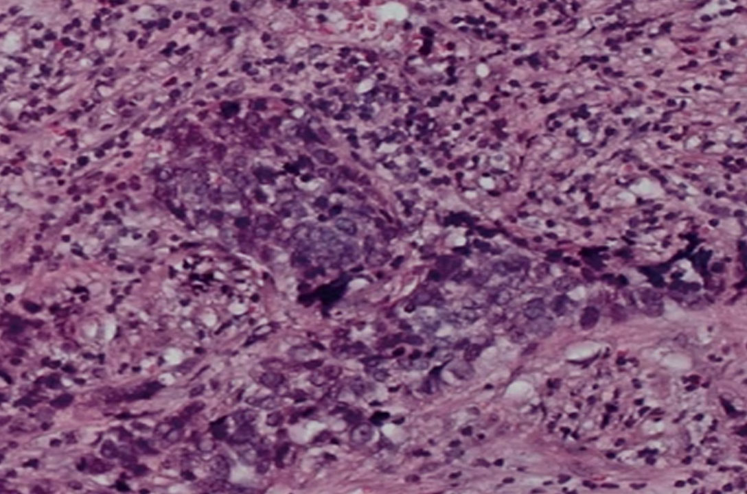 Microscope view of pink and purple stained tissue, likely a stained histology sample.