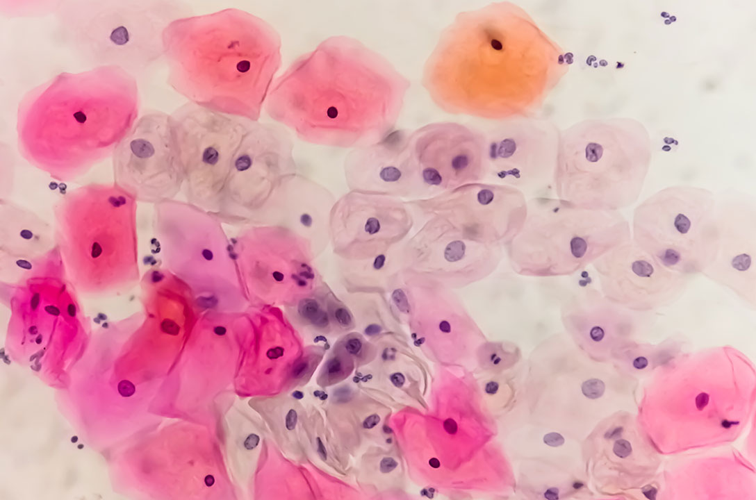 Microscope view of stained cells in pink, orange, and purple on a pale background.