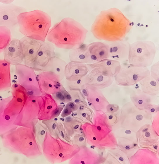 Microscope view of stained cells in pink, orange, and purple on a pale background.