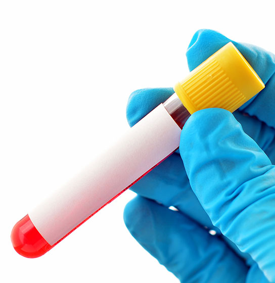 A blue-gloved hand holds a blood sample tube with a yellow cap and blank white label.